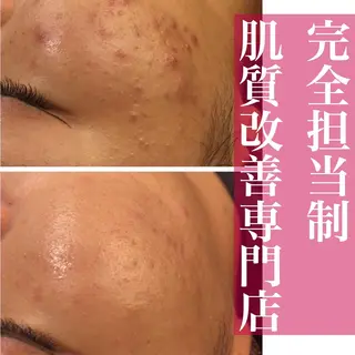 ミディアム カラー パーマ ヘアアレンジ メンズ キッズ ネイル マツエク・マツパ アイブロウ ニキビ・肌質改善専門 ♡人生が変わるサロンのエステ・リラクイメージ