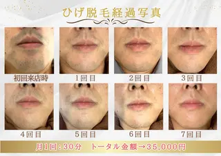 メンズ 都度払い専門　脱毛サロンHYGIENE BEAUTY ROOM 19B 仙台駅前東口店所属・脱毛サロン 19B(毛利)のエステ・リラクイメージ