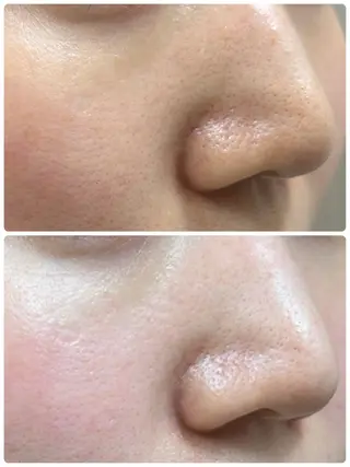 艶肌/角質ケア フェイシャルワックスのエステ・リラクイメージ