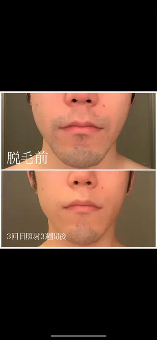 みんなの脱毛 TSURURINの眉毛・アイブロウイメージ