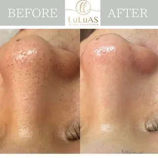 ルルアス GINZAのエステ・リラクイメージ