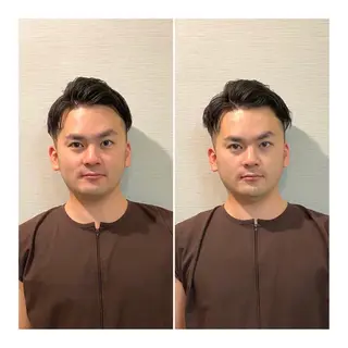 ロング メンズ 即小顔♥️美容鍼× ハーブピーリングのその他イメージ