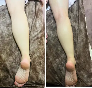 アロマ･美容鍼･カッ ピング「麗」鍼灸院のエステ・リラクイメージ