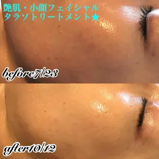 浜野 恵美のエステ・リラクイメージ