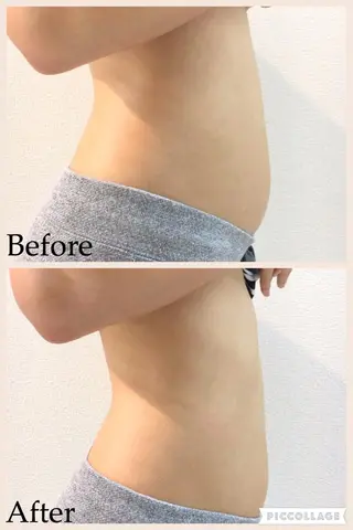 MIRYO 整体院のエステ・リラクイメージ