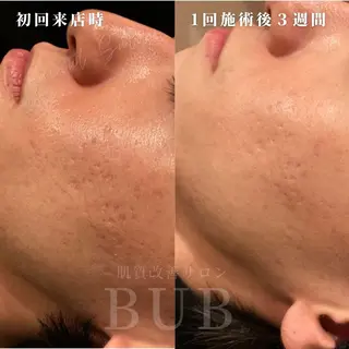 BIB PIBのエステ・リラクイメージ