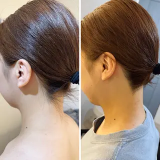 うなじ脱毛/美肌脱毛 LABELのエステ・リラクイメージ