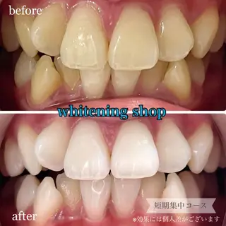 ホワイトニングショップ桜木町店所属・ホワイトニング ショップ桜木町店のエステ・リラクイメージ