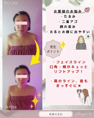 痩身ハーブピーリング 筋膜リリース☆B&Hのエステ・リラクイメージ