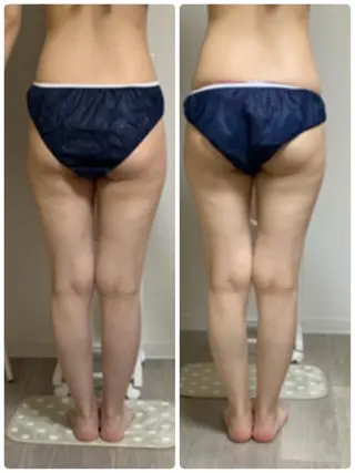 美ボディメイクサロン　only one body所属・所沢 痩身エステサロンのエステ・リラクイメージ