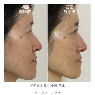 喜山 あつこのエステ・リラクイメージ