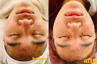 Beauty Zion所属・Beauty Zionのエステ・リラクイメージ