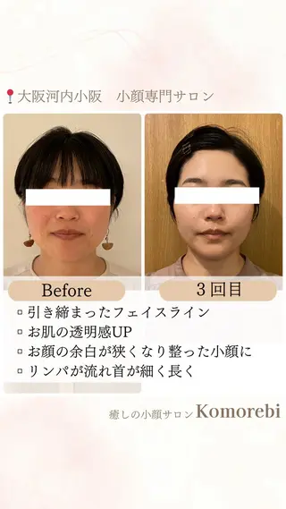 営業電話❌小顔サロン Komorebiのエステ・リラクイメージ