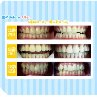 セルフホワイトニング Dolce水戸店のその他イメージ