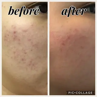 salon R 🌼Rieのマツエク・マツパデザイン