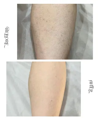 脱毛・肌質改善サロン Linoのエステ・リラクイメージ