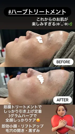 LiZA エステティックサロンのエステ・リラクイメージ