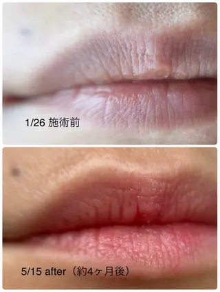 本気で痩せたい方へ 痩身専門サロンのエステ・リラクイメージ