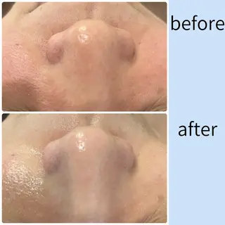 Mia.rosa所属・光フェイシャル・脱毛 MIA.ROSAの眉毛・アイブロウイメージ