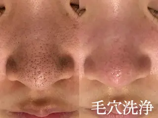 🌼SALON Lazuli久留米のエステ・リラクイメージ