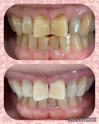 DIA WHITE 奥田のその他イメージ