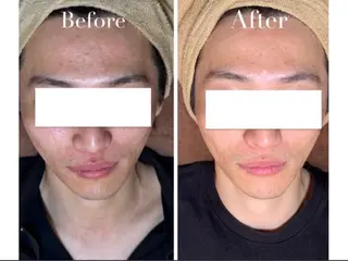 Avenir Brillant所属・松田 紗季のエステ・リラクイメージ