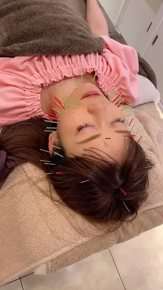 THE  ROOTS所属・美容鍼♡小顔矯正♡ fumikaのエステ・リラクイメージ