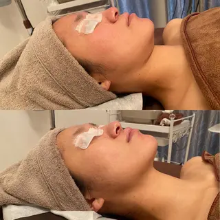 Remina clinical salon所属・ハイフ美肌専門 Remina.c.sのエステ・リラクイメージ