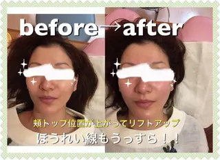 gomi sayakaのエステ・リラクイメージ