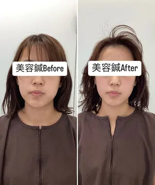 hari salon de off 美容鍼灸×小顔整体【ハリサロンドオフ】所属・美容鍼×小顔整体🤍 ishibashiのエステ・リラクイメージ