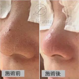 毛穴ケア専門店 esu(エス)のエステ・リラクイメージ