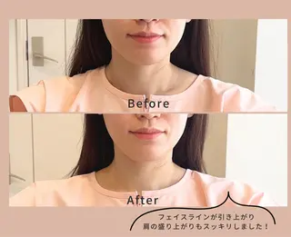 こつこつカメさん。所属・近藤美容 はりきゅう院のエステ・リラクイメージ