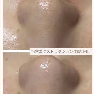 uni. abeのエステ・リラクイメージ