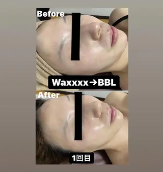 Epina 千葉店 【エピナ】のエステ・リラクイメージ