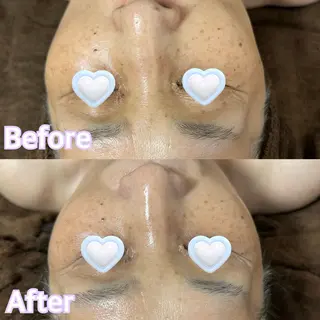 Kiamond所属・Kiamond キアモンドのエステ・リラクイメージ