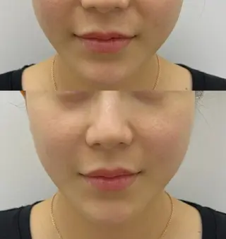 aliaハイフ&水光ジェットサロン所属・aliaハーブ水光店 エステティシャン募集のエステ・リラクイメージ