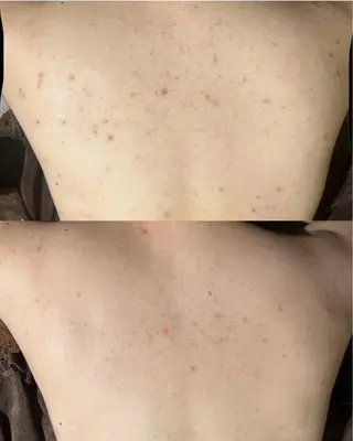 エミルカ　自由が丘店所属・花島 悠のエステ・リラクイメージ