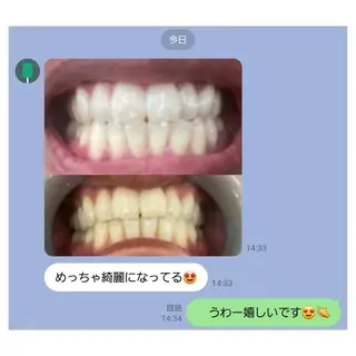 MBEAUTYSALON 千葉店・京成大久保所属・Melty 輝のその他イメージ