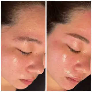 アイブロウ Ｂ&H所属・頭痛•肩こり専門/ 眉サロンB&H心斎橋のエステ・リラクイメージ