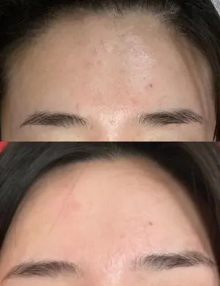 aliaハイフ&水光ジェットサロン所属・aliaハーブ水光店 エステティシャン募集のエステ・リラクイメージ