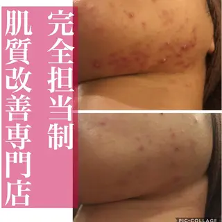 ミディアム パーマ ヘアアレンジ メンズ ネイル マツエク・マツパ アイブロウ ニキビ・肌質改善専門 ♡人生が変わるサロンのエステ・リラクイメージ