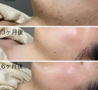 EL.ALLY イーエル.アリーのエステ・リラクイメージ