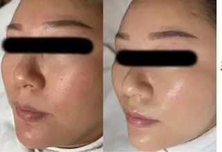 MONICAビューティサロン所属・MONICAサロン ⭐︎フェイシャル痩身のエステ・リラクイメージ