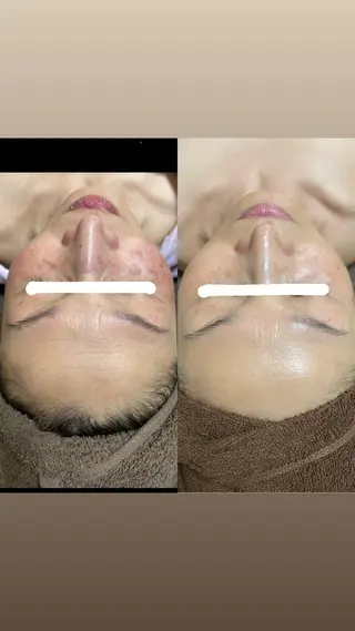 brilliance所属・老化肌トラブル肌専門 Brillianceのエステ・リラクイメージ