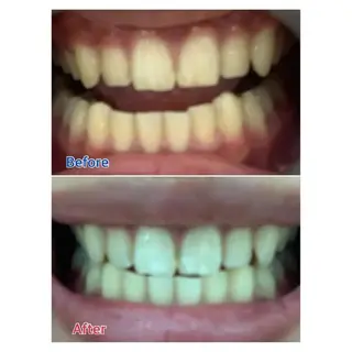 M渋谷店所属・M渋谷 ホワイトニングのエステ・リラクイメージ