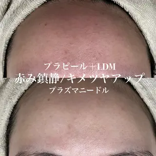 韓国肌管理&小顔 ＩＲＯＨＡのエステ・リラクイメージ