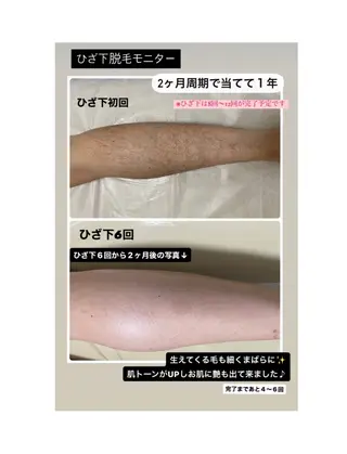 女性専用脱毛サロン エンジェルナンバーのエステ・リラクイメージ