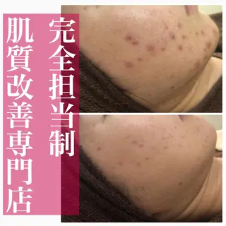 ミディアム カラー パーマ ヘアアレンジ メンズ キッズ ネイル マツエク・マツパ ニキビ・肌質改善専門 ♡人生が変わるサロンのエステ・リラクイメージ