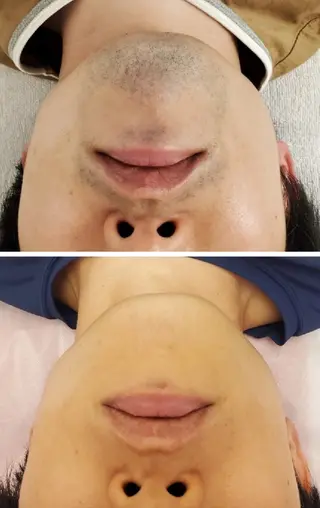 Salon Strawberry Moon所属・ストロベリームーン meguのエステ・リラクイメージ