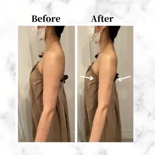 12Dハイフ💗 最強小顔のエステ・リラクイメージ